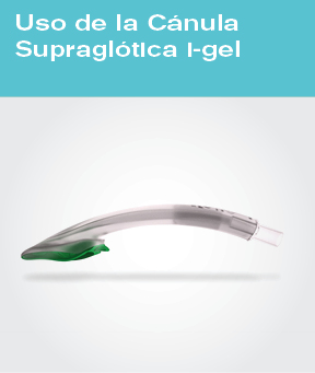 i-gel Supraglottic Airway - Posters